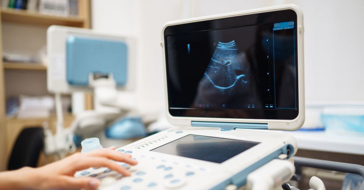 sonography